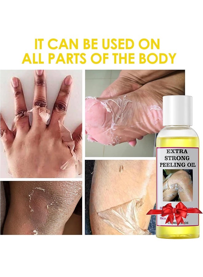 Extra Strong Peeling Oil Extra Strength for Dark Skin - Exfoliating Solution for Body, All Skin Types - 110ML/3.66 OZ - Image 2